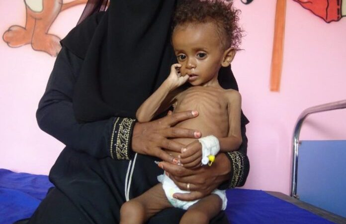 In ka badan 20 milyan oo ruux oo Cunno la’aan ku heysata Yemen!