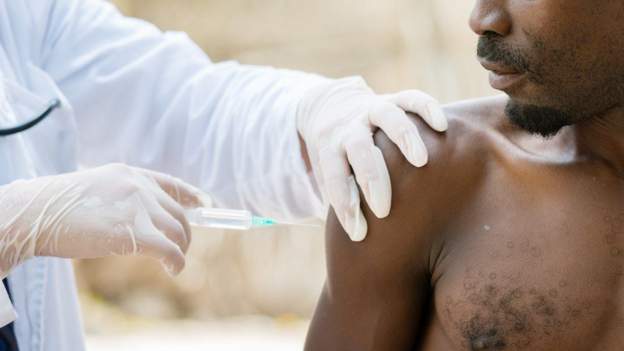 Talaalka HIV-ga oo ay tijaabadiisa ka bilabaatay Afrika