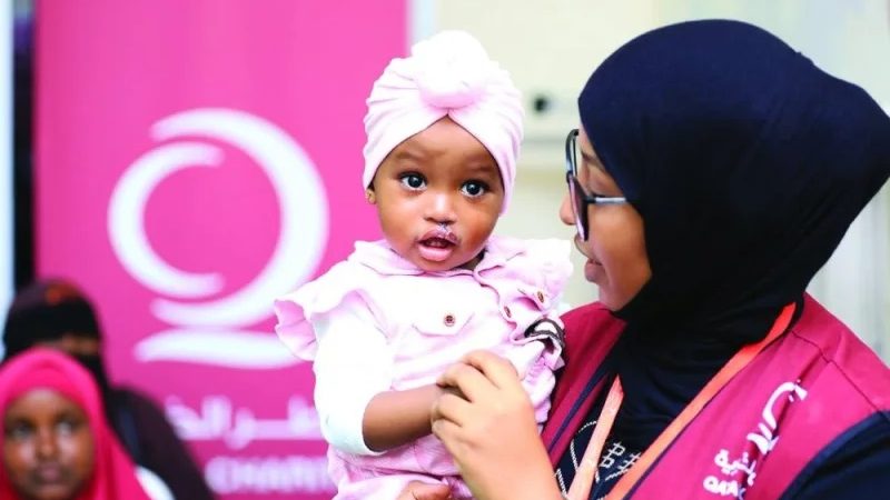 Qatar Charity performs surgeries on children with cleft lip in Somalia